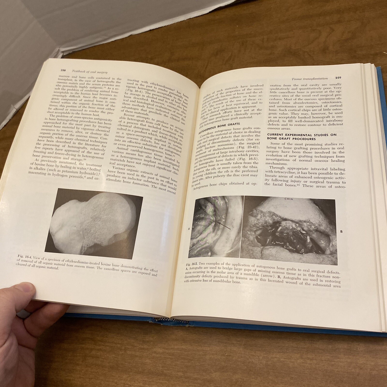 Textbook of Oral Surgery by Gustav O. Kruger (Hardcover) 3rd Edition 1968