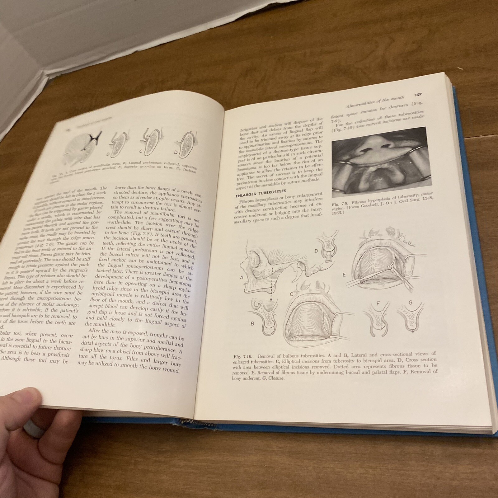 Textbook of Oral Surgery by Gustav O. Kruger (Hardcover) 3rd Edition 1968