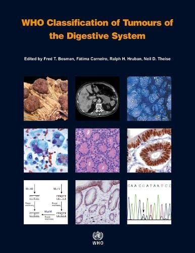 WHO Classification of Tumours of… by The International Ag Paperback / softback